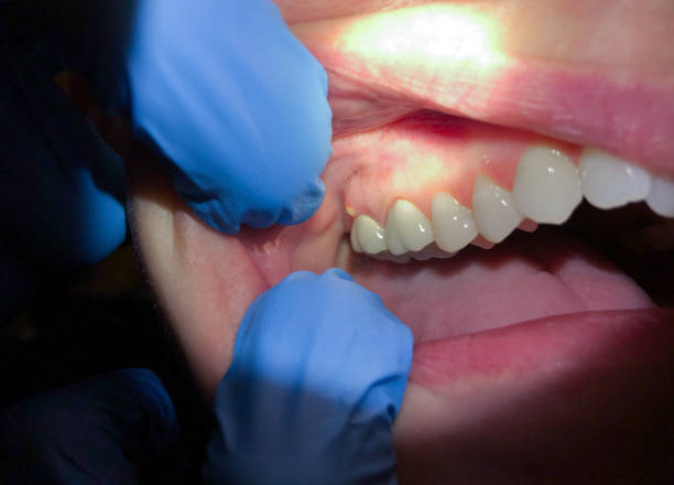 Best Pediatric Emergency Dentist in Cooper City, FL